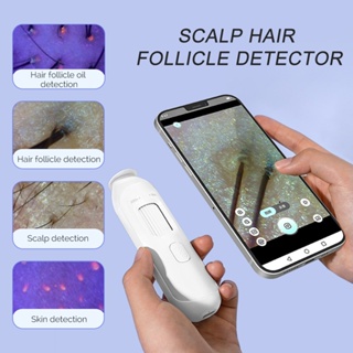 Foreverlily Multi-Função detector De Folículo Capilar Do Couro Cabeludo USB Microscópio Digital Para Cabelo Suporte Mult em Oferta na Shopee