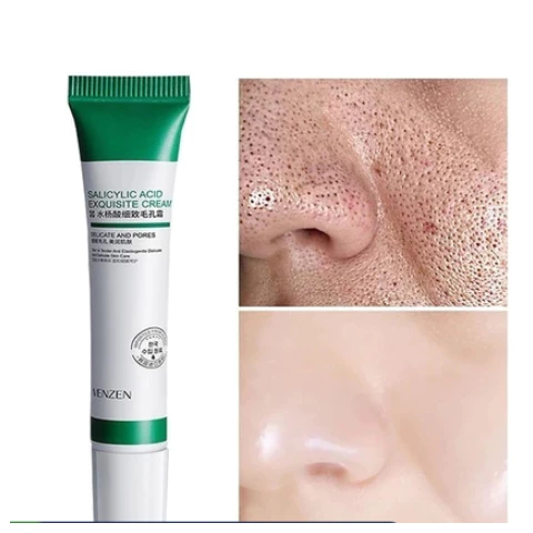 Creme De Ácido Salicílico 20ml Para Remoção E Clareamento De Poros/Acne/Controle De Óleo /