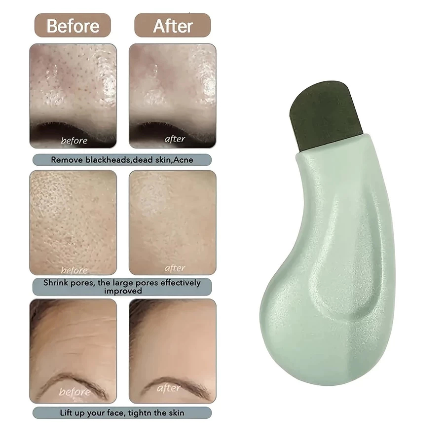 1 Peça Profissional Limpeza Profunda Nariz Cravo Espinha Ferramenta De Remoção Rosto Esfoliante Espátula Poros Mais Limp