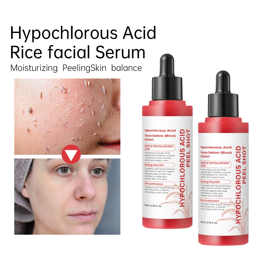 Sérum Facial Arroz Ácido Hipocloroso 80ml | Tiro De Casca Esfoliante Suave Ilumina A Pele E Reduz Cicatrizes De Acne Cui