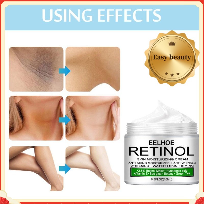 Creme De Clareamento Corporal , Peças Parlaulares , Soro Para Axilas , Joelho Brilhante , Parte Interna Da Coxa , Escuro em Oferta na Shopee