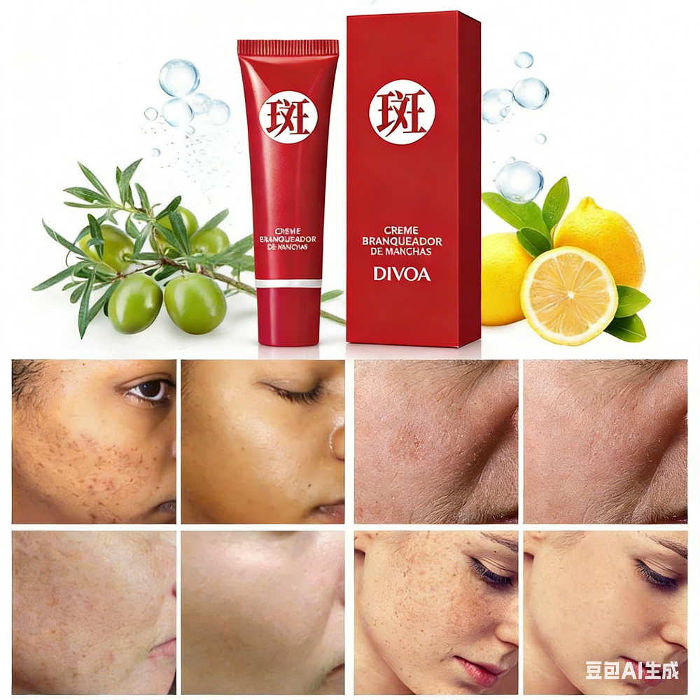 Creme para Manchas Escuras – Clareamento, Antipigmentação e Cuidados com a Pele em Oferta na Shopee