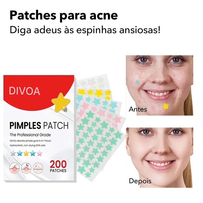 200pcs Acne Patch Adesivo Para Espinha Pimple Patch Estrela Desbotar Hidrocoloide Acne Master Patch Adesivo Para Acne em Oferta na Shopee