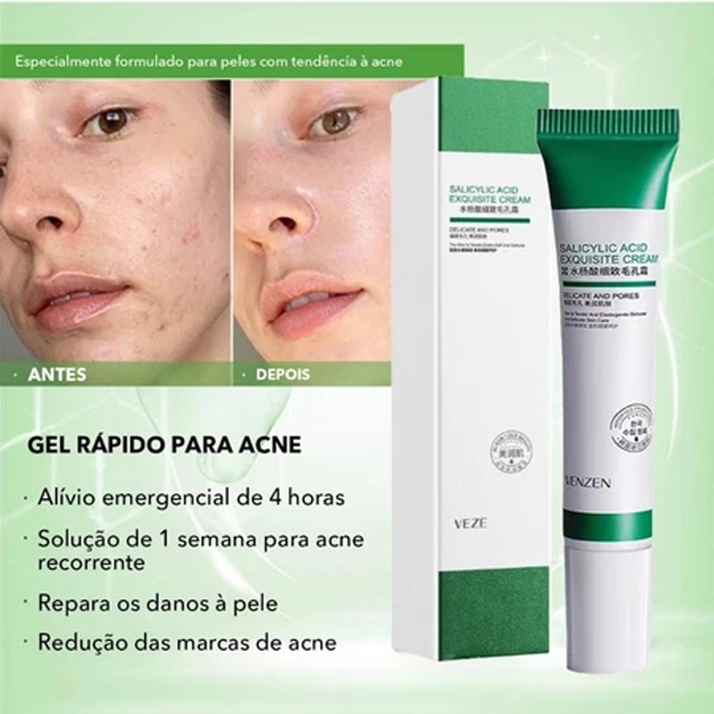 Creme de Ácido Salílico 20ml - Remoção De Poros e Acne, Clareamento de Cicatrizes Antigas