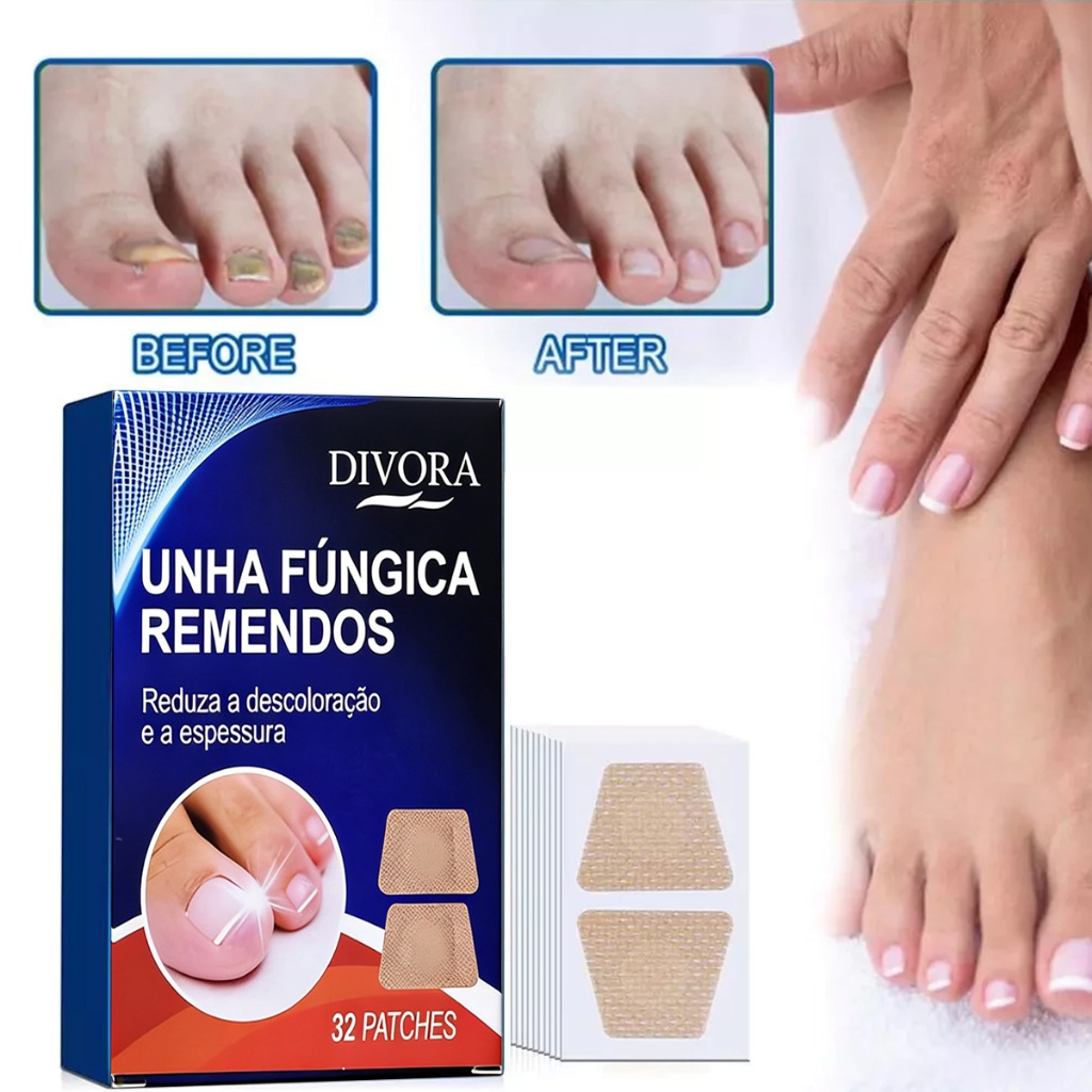 32/64pcs Adesivos De Tratamento Para Fungos Nas Unhas Anti Fungo em Oferta na Shopee