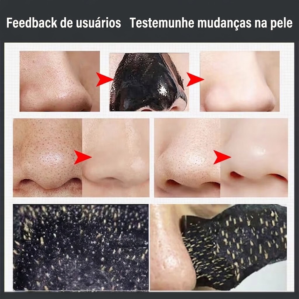 Máscara Removível Para Remoção De Cravos LYDIMOON , Pasta Nasal De Limpeza Profunda Com Carvão Ativado — imagem 2 de 2