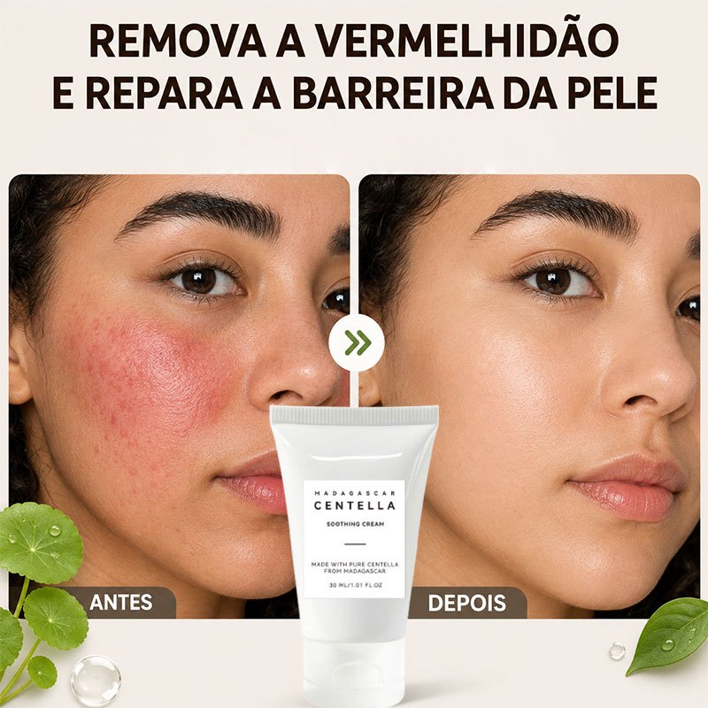Centella asiática creme Para Pele Sensível Vermelhidão 30ml Repara Barreira Cutânea hidratante facial