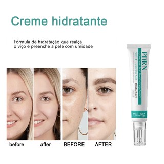 Hidratante Facial para Pele/Creme Hidratante Ácido de Qualidade 30ml