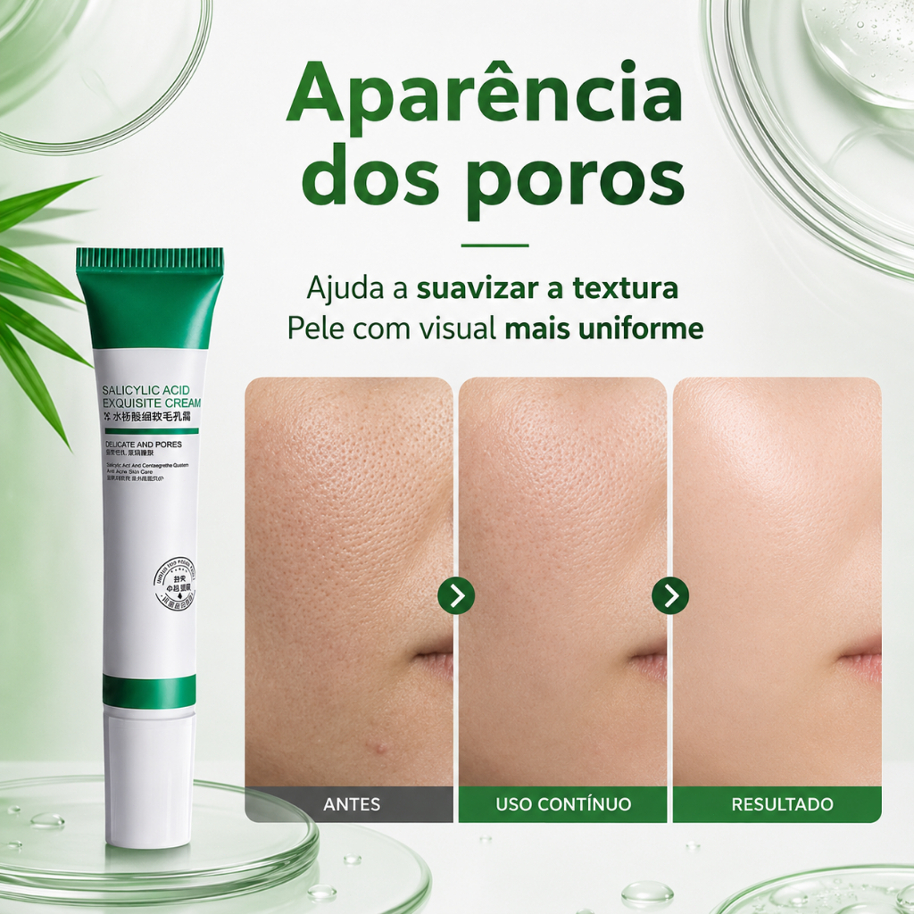 Creme De Ácido Salicílico 20ml Para Remoção E Clareamento De Poros/Acne/Controle De Óleo /