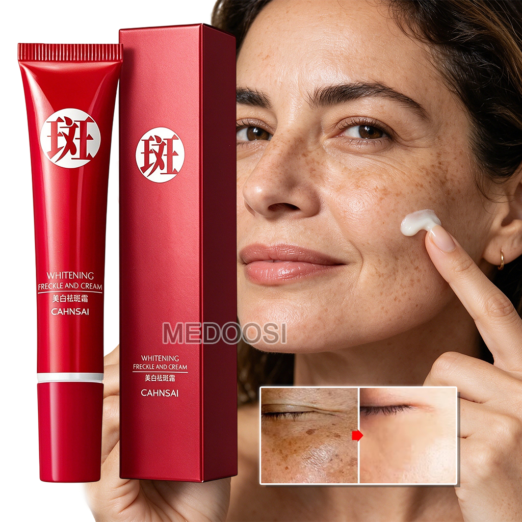 Creme Clareador Forte para Remover Manchas Escuras, Clarear Pigmentação e Iluminar o Tom da Pele - Cuidados com a Pele