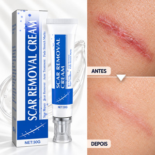 Creme Reparador De Cicatrizes Com Karité, Esqualano E Centella, 30g | Seguro Para Gravidez E Crianças