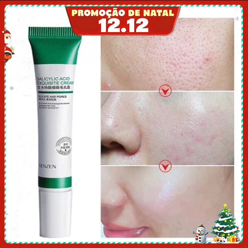 Cremes para Acnes: Onde Comprar | BuscaProdutos