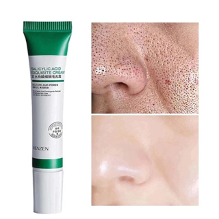 Creme Facial Antiacne 20ml | Desobstrutor de Poros, Redutor de Cravos e Espinhas, Controle da Oleosidade e Ação Clareado em Oferta na Shopee