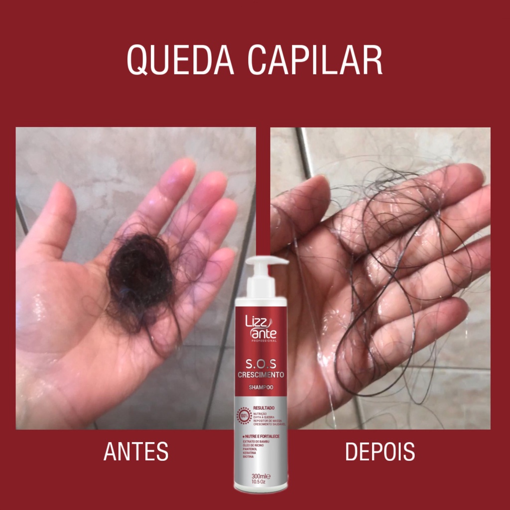 Shampoo SOS Crescimento 300 ml Lizz ante - Crescimento Acelerado - Preenche Falhas - Combate Calvice - Trata Alopécia - Aumento Volume Massa Capilar - Combate Caspa Oleosidade - Hidrata - Brilho - Cabelo Ressecado - Keratina - Óleo Rícino - Biotina