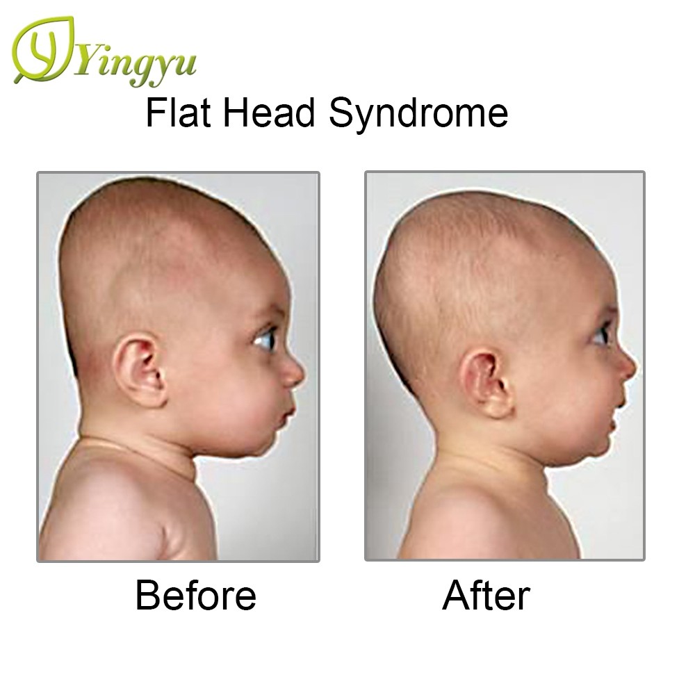 best pillow for plagiocephaly