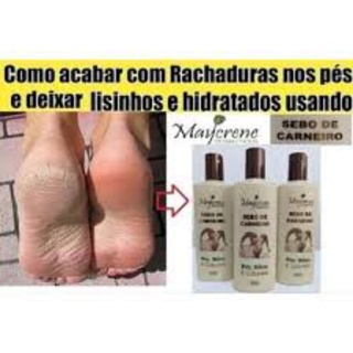 Sebo De Carneiro Com Uréia Para Rachaduras Dos Pés E Cutuvelos
