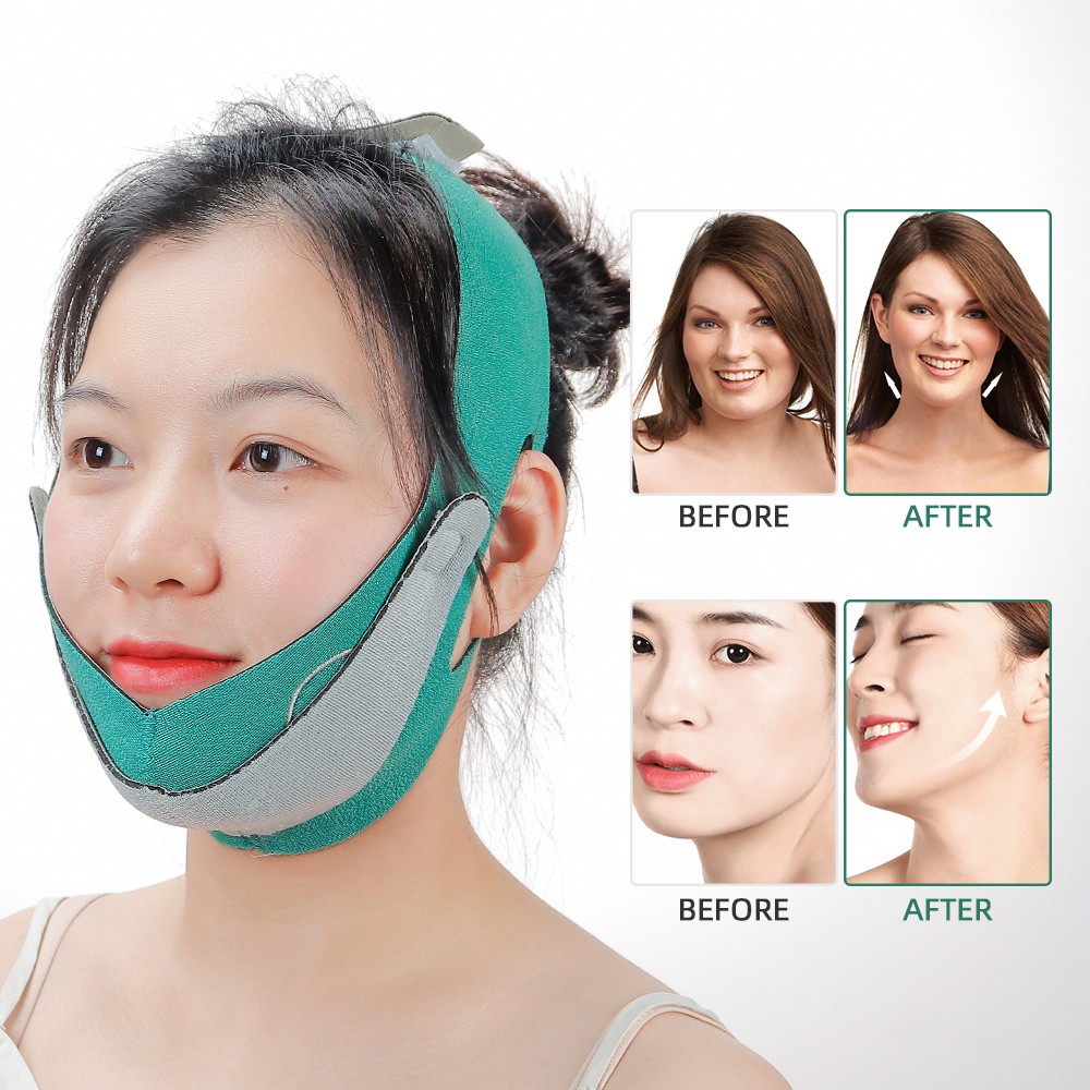 Jaw Shaper Before And After