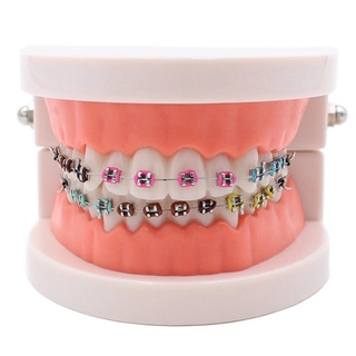 Modelo Dental Descascar Com Colorido/De/Dente