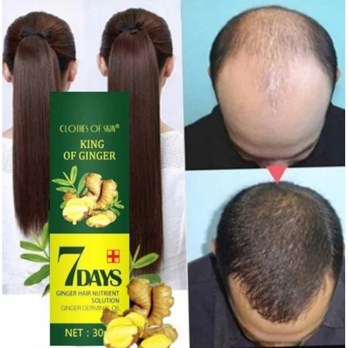 tonico capilar 7 Days Soro Anti-queda gengibre Crescimento Cabelo Pronta Entrega