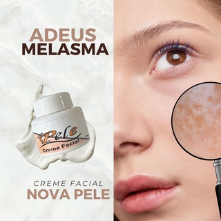 Creme Nova Pele Melasma Original