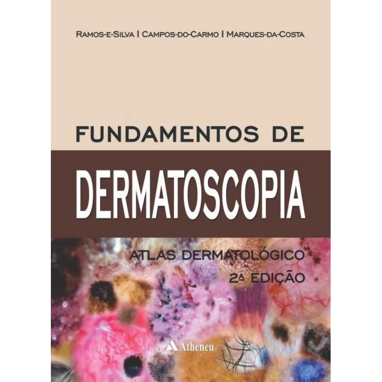 FUNDAMENTOS DE DERMATOSCOPIA ATLAS DERMATOLÓGICO