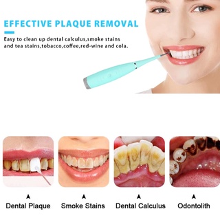 Removedor De Tártaro Cálculo Dental Elétrico Raspador Usb