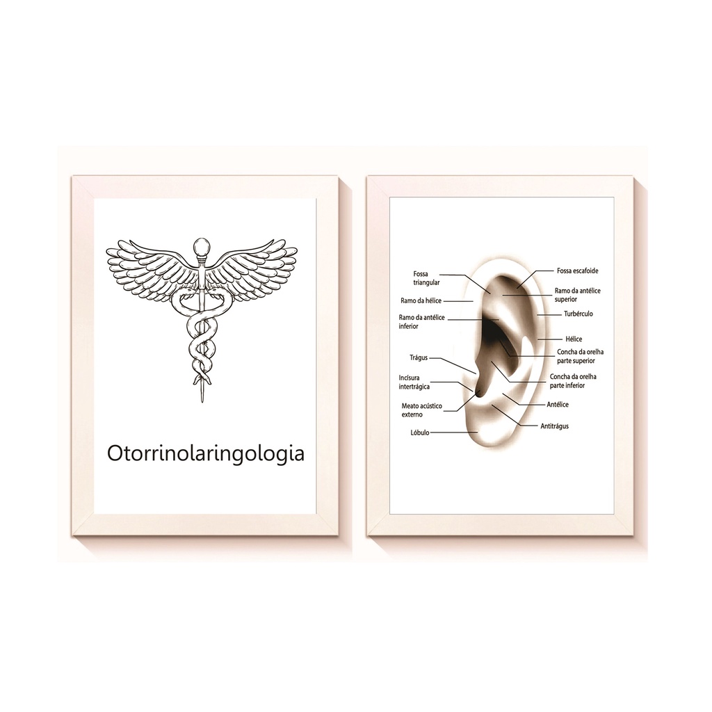 Kit 2 Quadros Decorativos Ouvido Decoração Consultótio de Otorrinolaringologia Molduras 20x30cm Madeira
