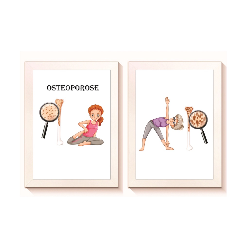 Kit 2 Quadros Decorativos Osteoporose Reumatologia Ortopedia Endocrinologia Medicina Molduras 20x30cm Madeira Vidro