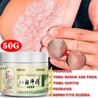 Bacteriostase Creme Antiprurítico E Reparador Da Pele Aliviar A Psoríase Dermatite Eczema Pruritus Com De