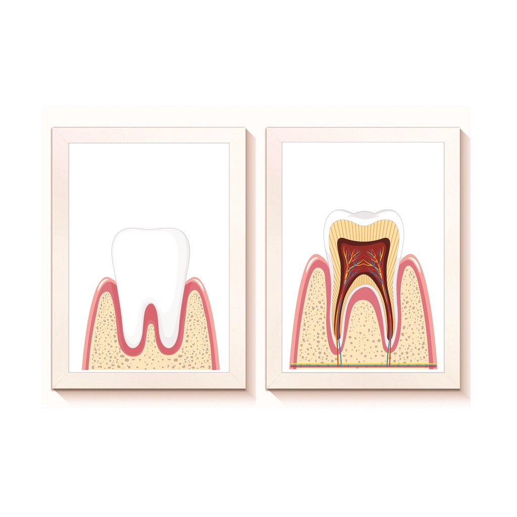 Kit 2 Quadros Decorativos Dente Decoração Consultório Odontologico Moldura 20x30cm Madeira