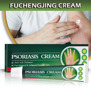 Creme De Tratamento Psoríase Dermatite Pruritus Anti-Itch Ointment Body Psoriasis