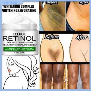 50ml Eelhoe Retinol Creme Clareador Facial Corporal Pernas Branqueadoras Joelhos Sol
