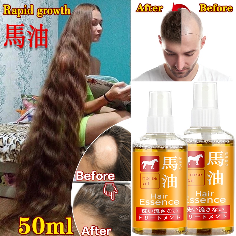 Spray De Crescimento De Cabelo Natural De Cavalo , Cuidados Com O E , Previne Queda , Biotina Rápido