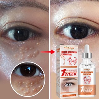 Eficaz Remove O Granulado Gordo Creme Para Olhos Melhora Bolsa Dos Linhas Finas Hidratante Anti-Puffiness Lifting Firmeza Soro De Cuidados Com Os