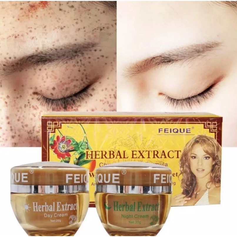 [Conjunto] 20gX2 Creme Facial Dia E Noturno , Remoção De Ervas Naturais Clareador Ponto Escuro Anti Melanina