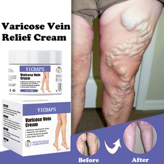 Creme De Varizes Eficazes De Ervas , Pomada De Vasculite , Flebite , Aranha , Alívio Da Dor , Gesso Beleza , Cuidados Corporais , 50g