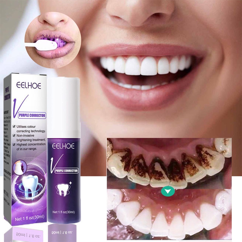 Creme Clareador De Dentes Dental Freshen Breath Remove Manchas De Fumaça Higiene Oral Limpar Eficaz Remoção Amarelos Cuidados Odontológicos