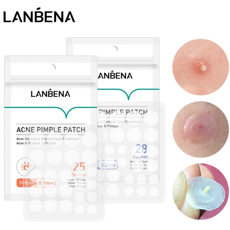 LANBENA Remoção De Acne Patch Remover Adesivos Para Cuidados Com A Pele De Borbulhas Pretas Patch De Coluna / Acne