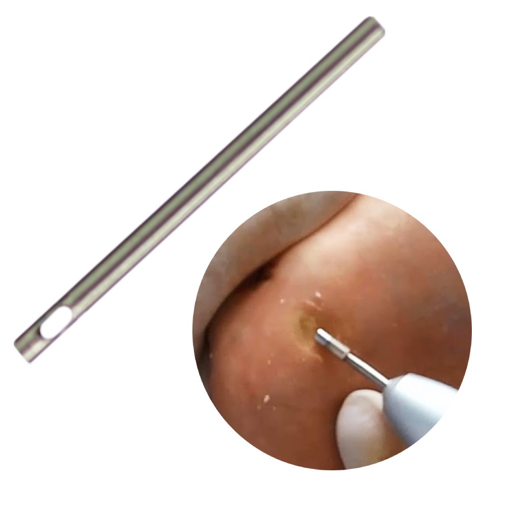 Broca Enucleadora Podologia: Onde Comprar | BuscaProdutos