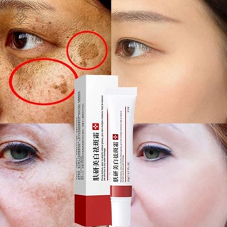 Creme Clareador Para Remover Melasma Remove Manchas Escuras, Remove Melanina, Remove Melasma, Pele Brilhante