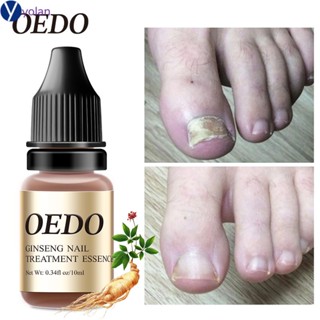 OEDO Eficaz Remoção de Fungos Tratamento de Unhas Óleo de Essência Hidratante Cuidados para Unhas dos Pés Líquido 10ml Yolan