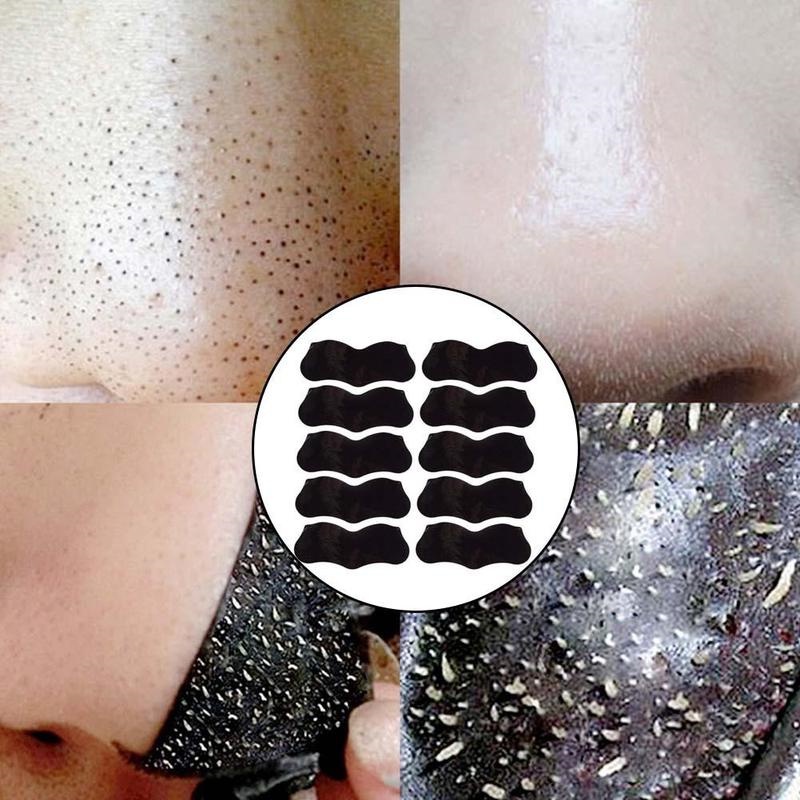 1 Pçs Cravo Tratamento De Acne Adesivo Removedor De Nariz Máscara De Ponto Preto Poros Limpador Cuidados Com A Pele Prof