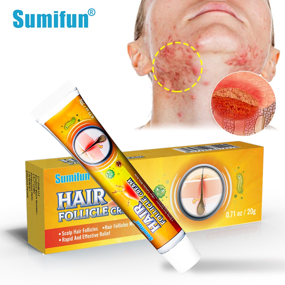 Tratamento De Foliculite Capilar Cistos De Pomada Papulas Removedor De Manchas Pustules Úlceras Da Pele em Oferta na Shopee