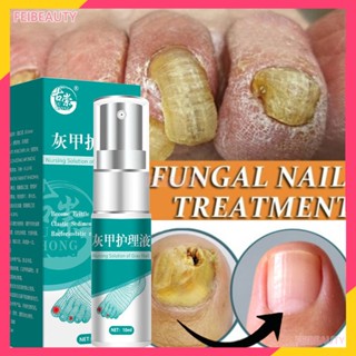 1Pcs Tratamentos De Fungos De Unhas Soro Spray Essência De Pulverização De Remoção Gel Anti-Infecção Paroníquia Onychomycosis