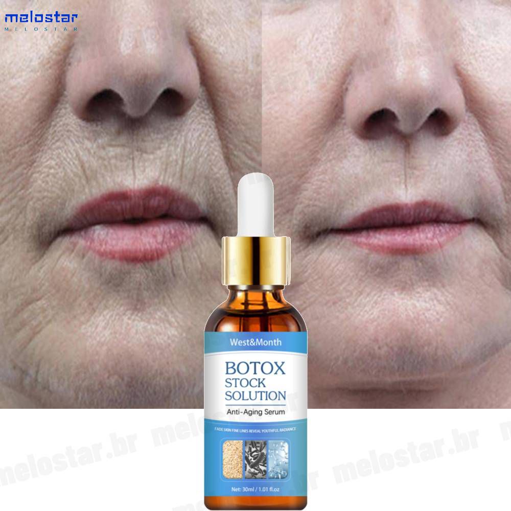 Botox Stock Solution Sérum Facial Clareador Anti-rugas Botox Original Líquido 30ml Sérum Facial Anti-manchas Clareador Anti-idade Melostar