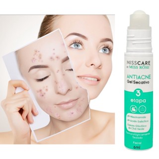 Gel Secativo AntiAcne com Niaciamida e Ácido Glicólico Miss Rôse