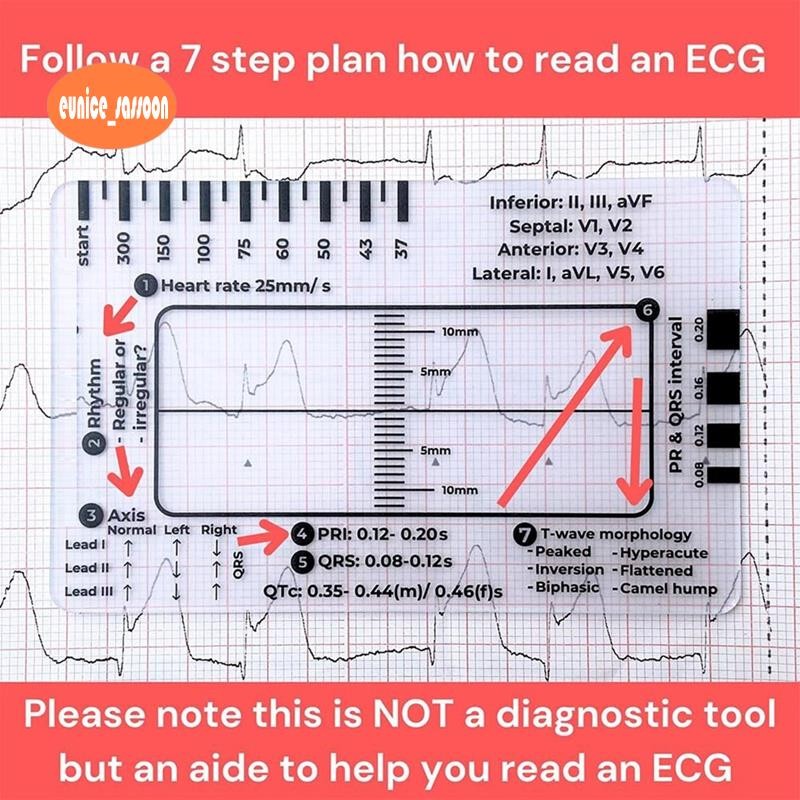 Régua De 7 Etapas ECG , Para Interpretação De/EKG , Análise Cardíaca Rápida E Ferramenta De Medição