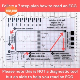 Régua De 7 Etapas ECG , Para Interpretação De/EKG , Análise Cardíaca Rápida E Ferramenta De Medição em Oferta na Shopee