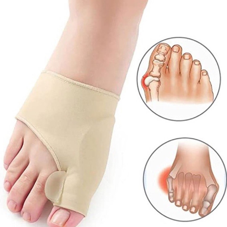1 Par Corretor Joanete Reforçado Alivia Dor Corretivo Correção Separador De Dedo