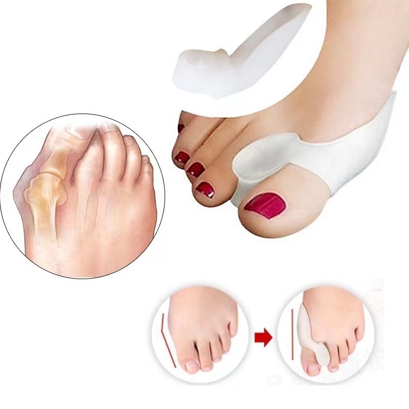Joanete Protetor de de Silicone Ortopédico Pé Macio Confortável Par Corretor Hallux Valgus Palmilha/Joanete Corretor de